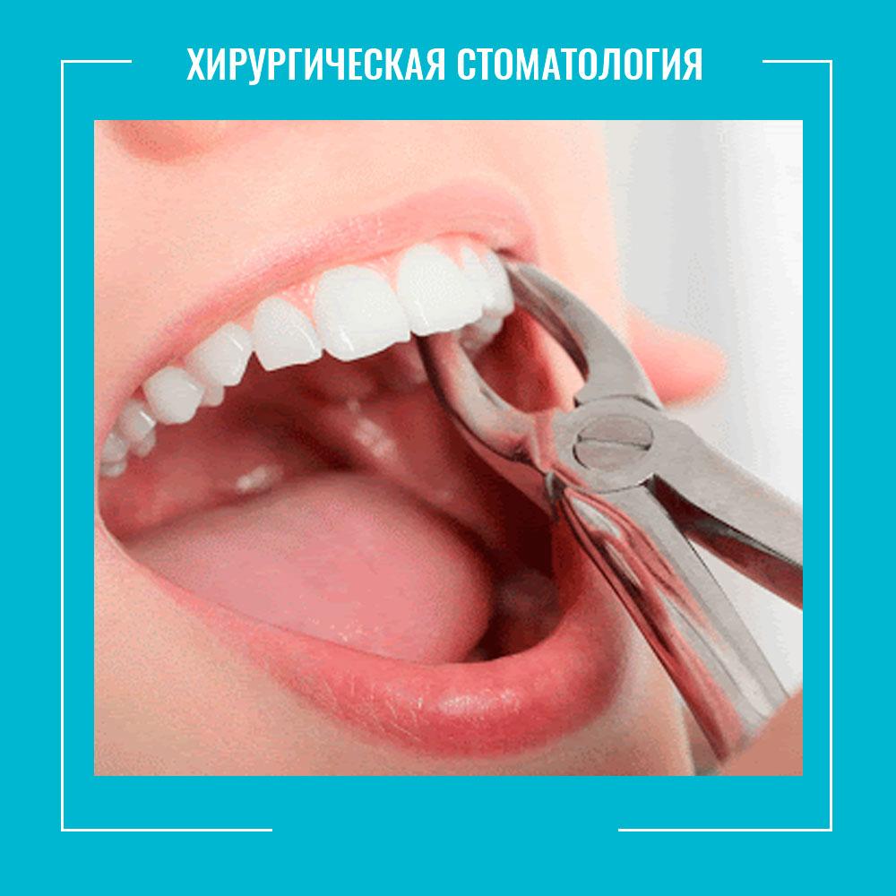 хирургическая-стоматология