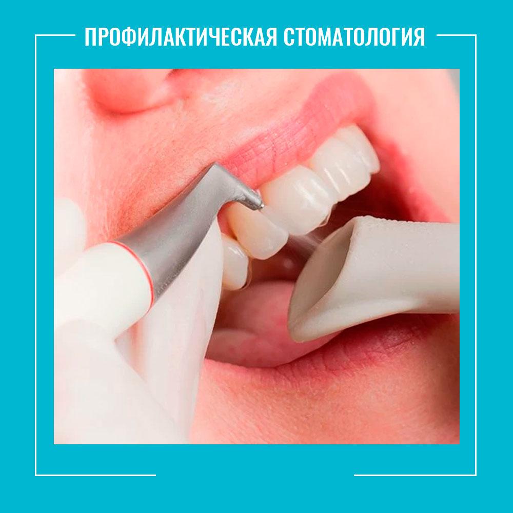 профилактическая-стоматология